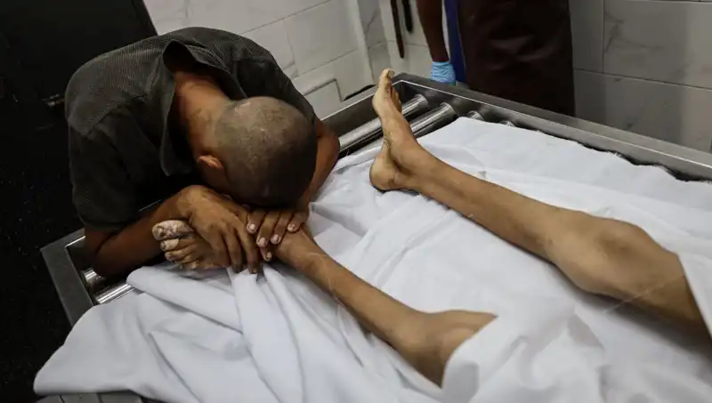 Gazze'de Çocukların Açlıkla Mücadelesi: Bir Hayat Daha Kaybedildi